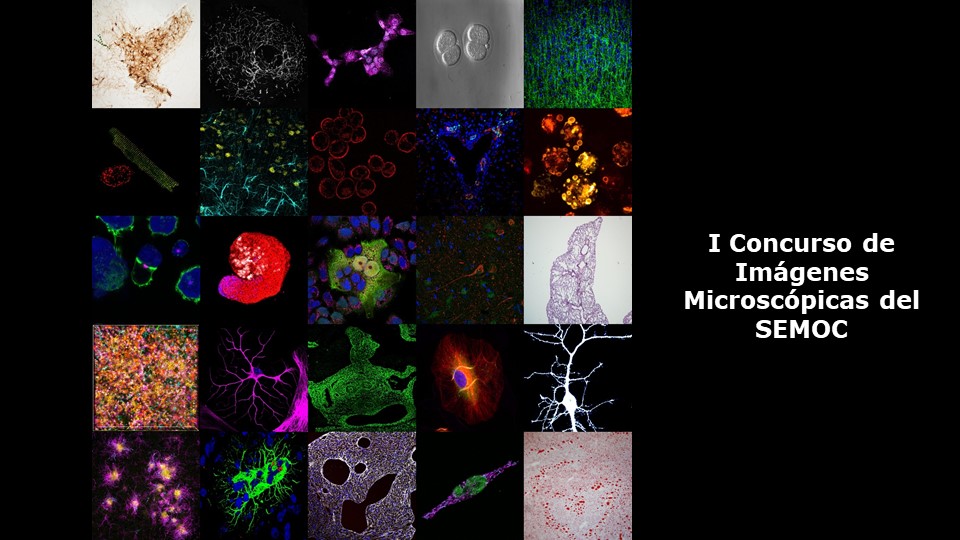 I Concurso de Imágenes Microscópicas SEMOC 2025